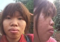 越南凤姐整容后的样子 嫁给富二代后现原形被甩