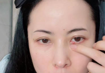 蚌精杨明娜直播否认整容（瘦脸针都没有打过完完全全是天然脸）