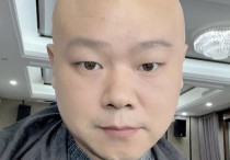 岳云鹏发光头照问网友帅吗师弟朱鹤松反问岳岳你觉得呢
